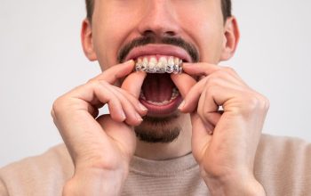Invisalign Sydney