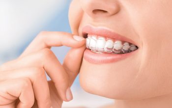 Expert Dental Implant Placement in Manchester: What You Need to Know
